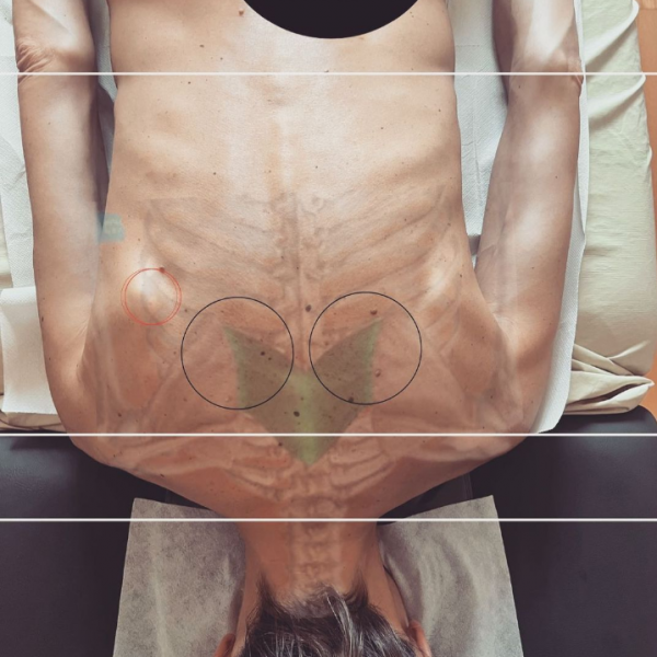 MAT- Myoskeletal Therapie